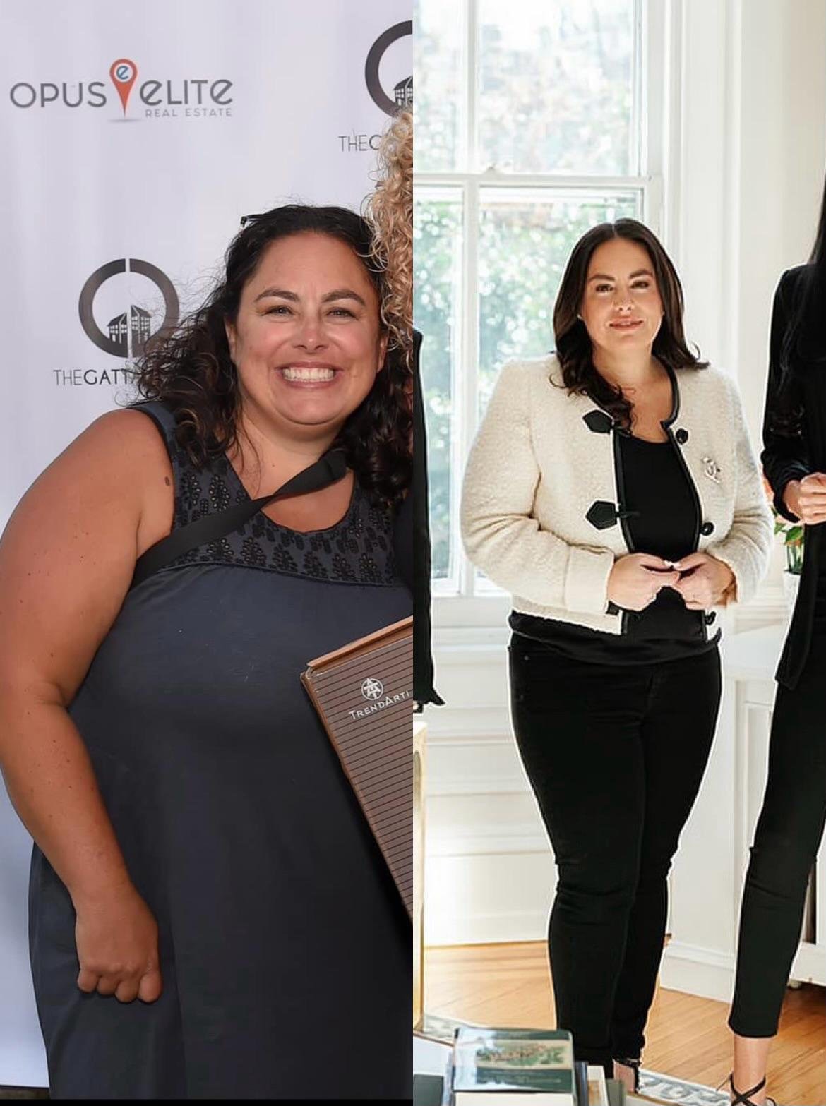 Patient before and after progress image showing visible transformation